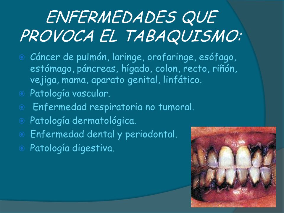 5 enfermedades del tabaquismo